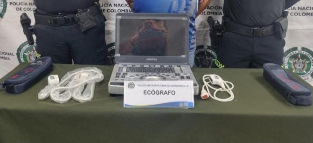Capturado por el delito de receptación en Barranquilla; Recuperan ecógrafo pediátrico valorado en $100 millones 1 Screenshot 20250527 151743