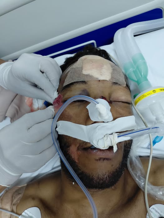 Buscan a familiares de hombre arrollado en Cordobita: se encuentra herido en centro médico de Ciénaga 1 515141871 1174802367995141 3386752463827675579 n