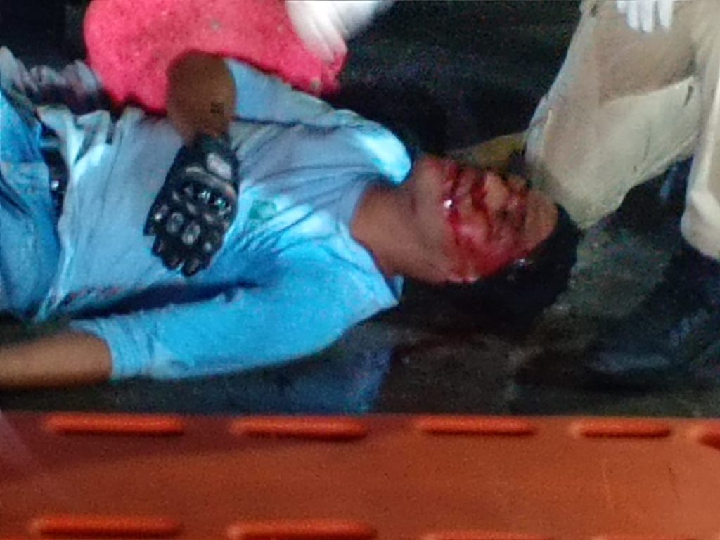 Accidente entre moto y bus en la calle 30 de Barranquilla deja dos heridos 2 6109d27e 5381 4bf5 8d5d e18be852da32