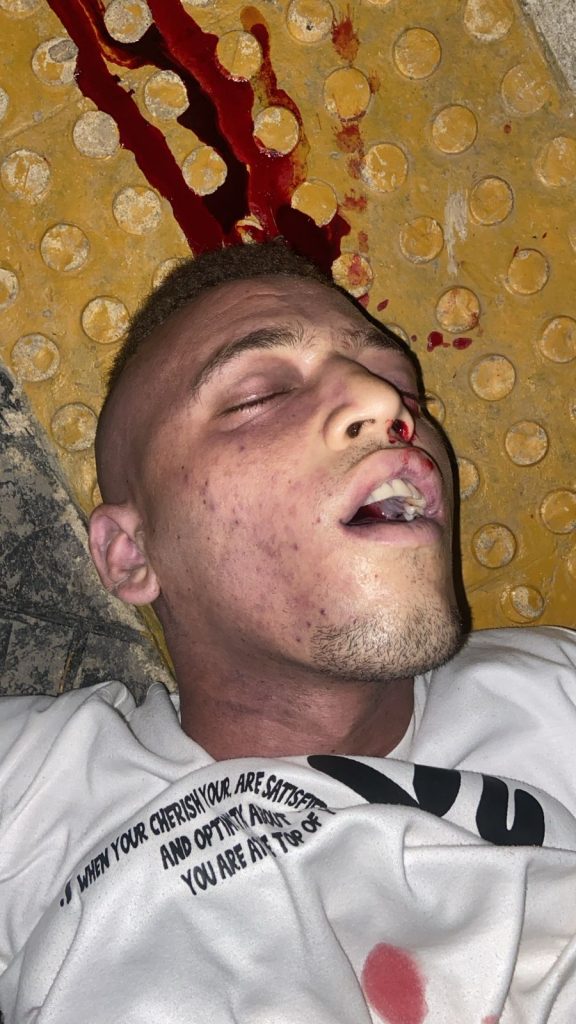 Sabanalarga bajo fuego: dos jóvenes asesinados en menos de cinco horas en un nuevo atentado armado 2 65cc5d54 b64d 42d6 b2ab 11998cf5bd11