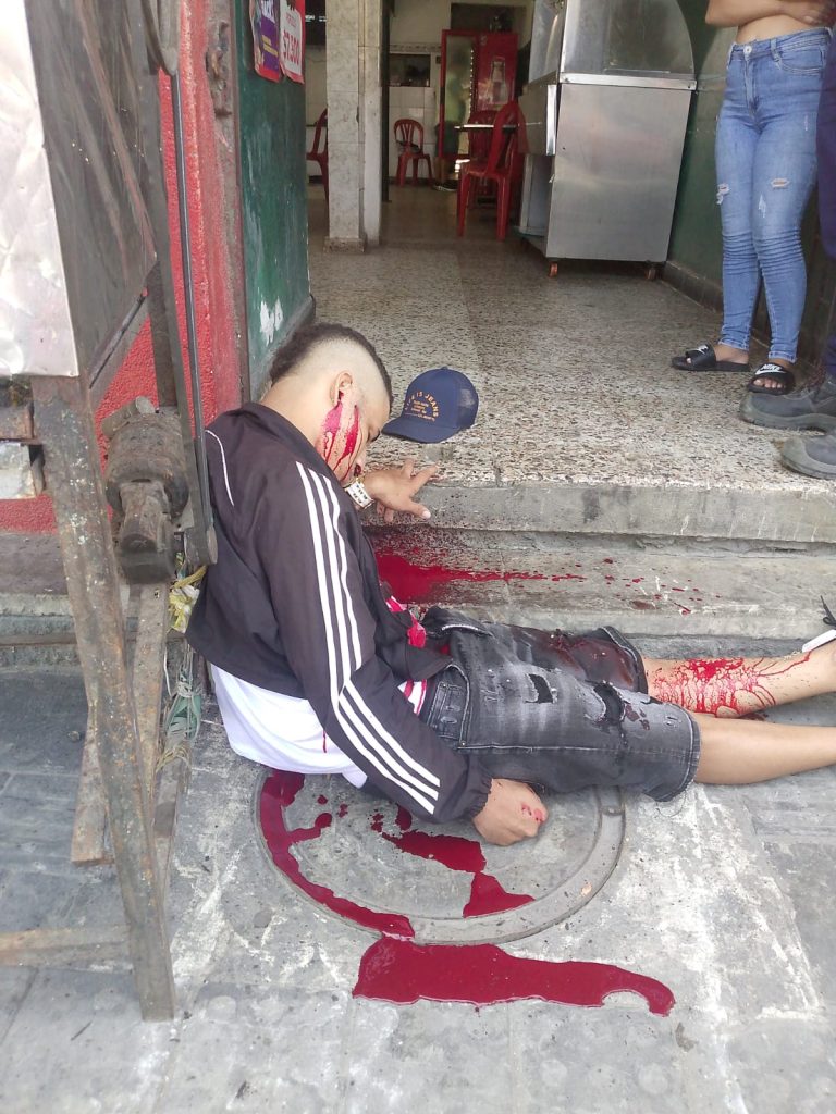 Ultimado joven frente a un asadero de pollo en la calle 30, barrio San Roque 1 af6dd95d 401f 441b b423 49fe2f70c525
