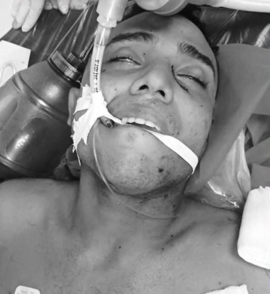 Atentado sicarial en Barranquilla deja una mujer muerta y un policía gravemente herido 1 32a20a56 81ca 4a89 85f9 efc81cdb6b36