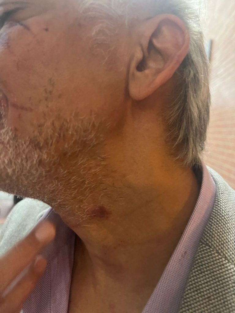 ace7cd24 ffa7 4974 90fb 92bf994d42fb