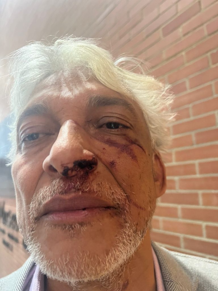 d05054d2 b3a5 4d93 8bf1 b32a4a9a32a4