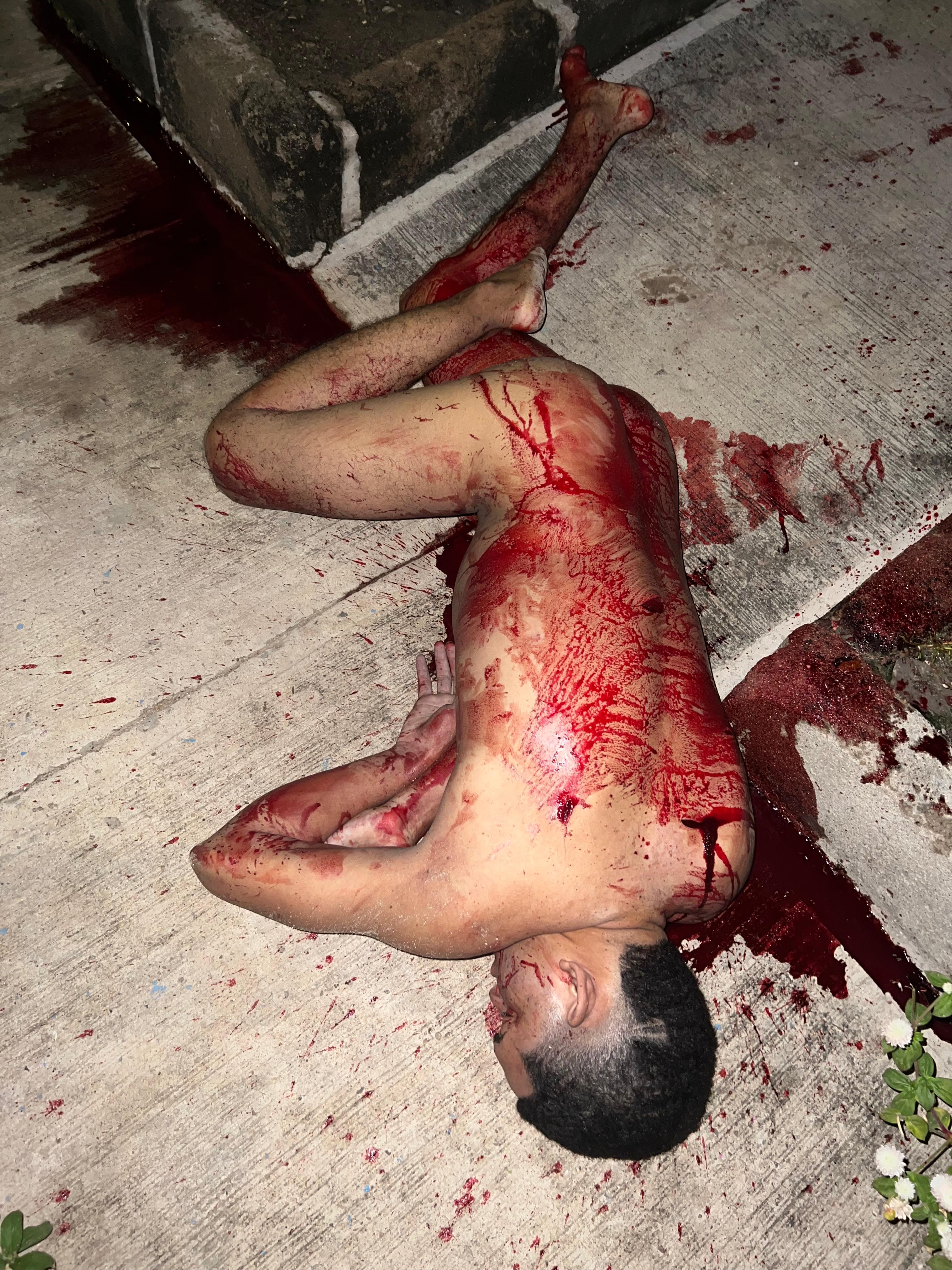 Violento ataque por presunta infidelidad deja un hombre muerto y una mujer gravemente herida en Bosconia 1 47a8c0ba 1077 4983 ad5b e1a8f1a26556