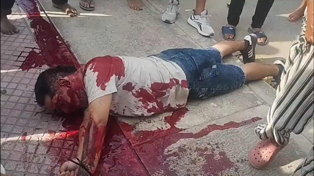 Joven es hallado atado de manos y herido en inmediaciones del cementerio Santa María de Barranquilla 1 gettyimages 1338507475 49596026 20251229185048 39
