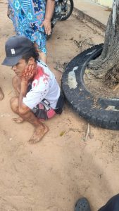 Joven resulta herido en atentado sicarial en Pivijay 1 0db849ef 62a3 4496 b75b ef526b4a7ebb